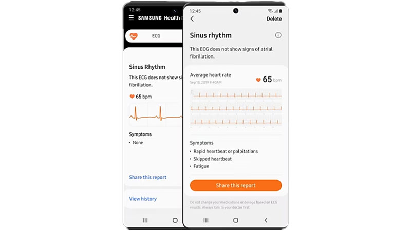 ECG readings